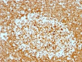 Anti-CD74 Antibody Cocktail