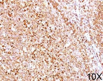 Anti-CD79a Antibody