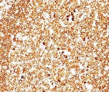 Anti-CD79a Antibody Cocktail