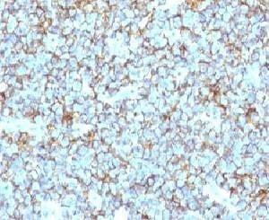 Anti-CD99 Antibody