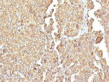 Anti-Chromogranin A Antibody Cocktail