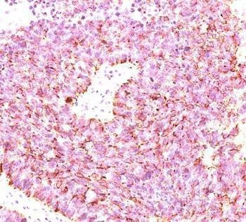 Anti-Chromogranin A Antibody Cocktail