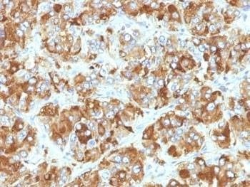 Anti-Chromogranin A Antibody