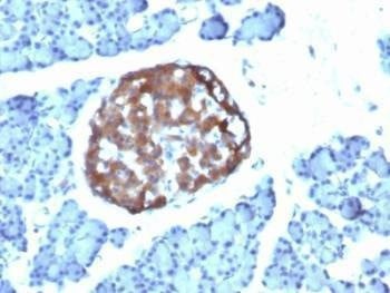 Anti-Chromogranin A Antibody