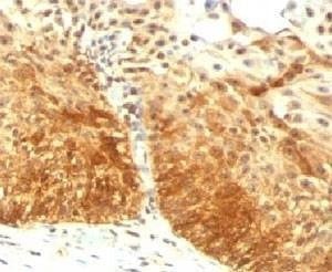Anti-Cytokeratin 14 Antibody