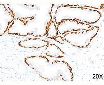 Anti-Cytokeratin 14 Antibody