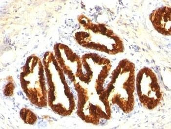 Anti-Cytokeratin 18 Antibody Cocktail