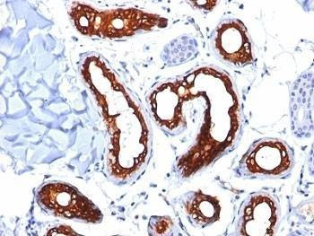 Anti-Cytokeratin 18 Antibody