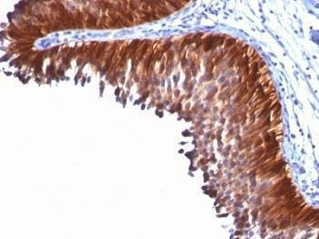 Anti-Cytokeratin 18 Antibody