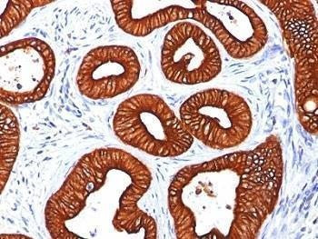 Anti-Cytokeratin 18 Antibody