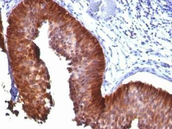 Anti-Cytokeratin 18 Antibody