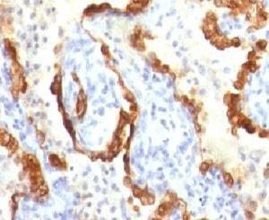 Anti-Cytokeratin 18 Antibody