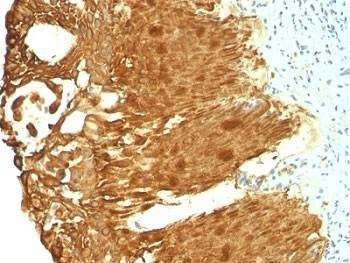 Anti-Cytokeratin 19 Antibody Cocktail
