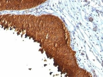 Anti-Cytokeratin 19 Antibody Cocktail