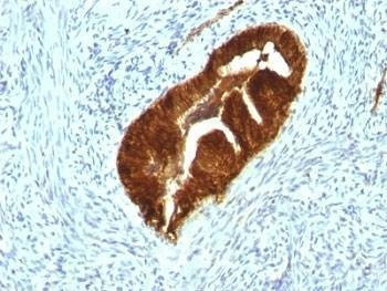Anti-Cytokeratin 19 Antibody Cocktail