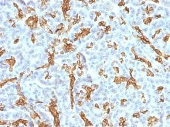 Anti-Cytokeratin 19 Antibody Cocktail