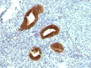 Anti-Cytokeratin 19 Antibody