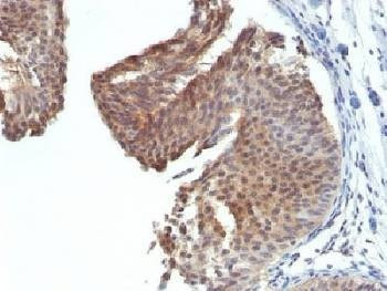 Anti-Cytokeratin 6 Antibody
