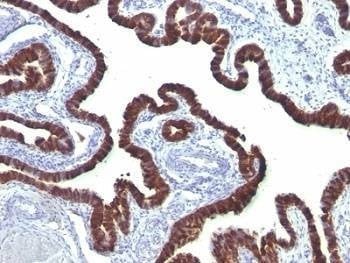 Anti-Cytokeratin 7 Antibody
