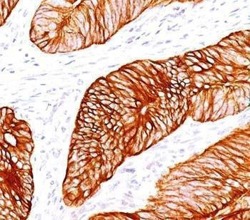 Anti-Cytokeratin 8 Antibody Cocktail