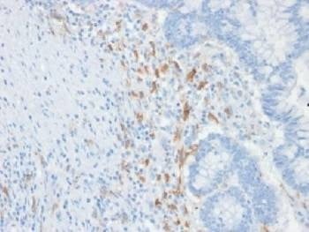 Anti-DC-SIGN / CD209 Antibody