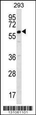 Anti-DAZ2 (C-term) Antibody