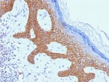 Anti-Desmoglein 3 / DSG3 Antibody