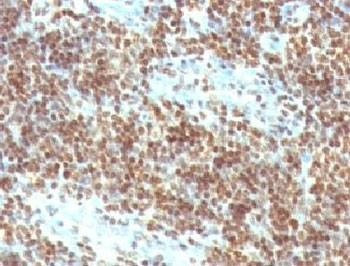 Anti-Double Stranded DNA Antibody