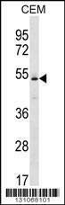 Anti-KCNJ4 (N-term) Antibody