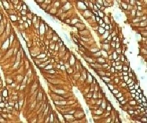 Anti-EpCAM Antibody