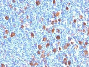 Anti-Fascin Antibody