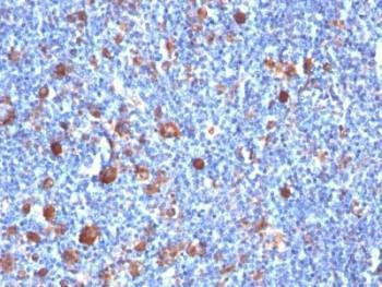 Anti-Fascin Antibody