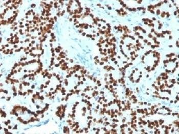 Anti-FOXA1 Antibody
