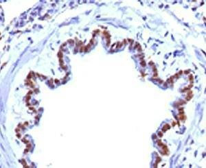 Anti-FOXA1 Antibody