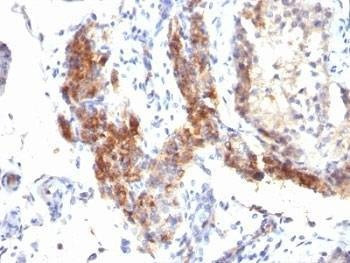 Anti-FOXP3 Antibody