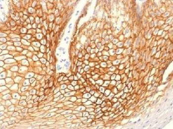 Anti-Gamma Catenin / Plakoglobin Antibody