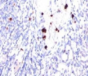 Anti-G-CSF Antibody