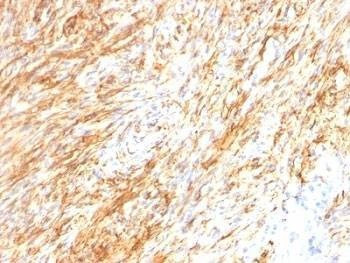 Anti-GFAP Antibody Cocktail
