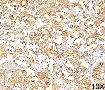 Anti-gp100 Antibody