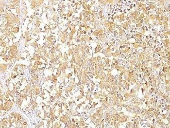Anti-gp100 Antibody