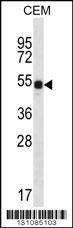 Anti-DAZ3 (C-term) Antibody
