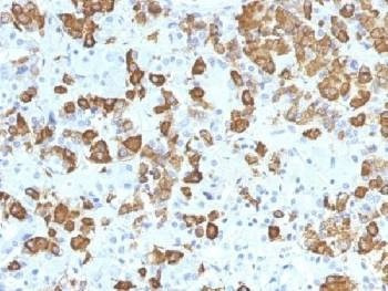 Anti-Growth Hormone Antibody (pituitary)