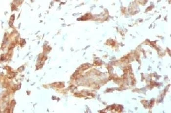 Anti-GRP94 Antibody