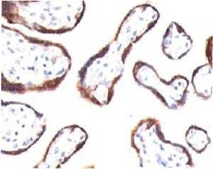 Anti-HCG-beta Antibody