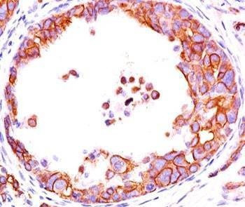 Anti-HER2 Antibody ErbB2