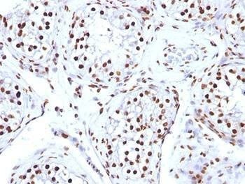 Anti-Histone Antibody
