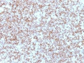 Anti-HLA-DR Antibody (HLA-DP)