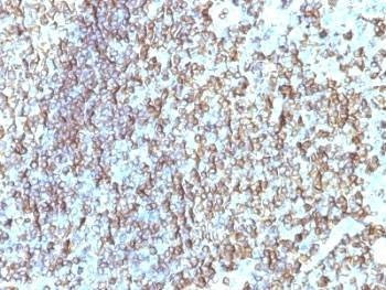 Anti-HLA-DRB1 Antibody (MHC II)