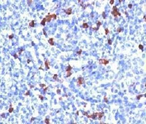 Anti-IgG Antibody