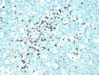 Anti-IgM Antibody